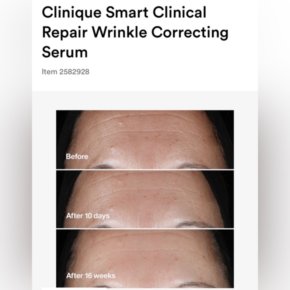 Clinique Smart Clinical Repair Anti-Aging Serum - Picture 5 of 11